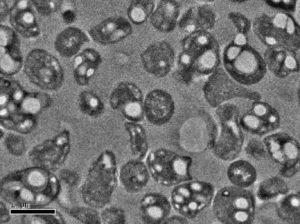 The image is depicting bacteria that use methane gas as a food source and that synthesize PHB polymer inside their cells. PHB polymers are the white globules inside the cells. The image (courtesy of Mango Materials) is obtained using transmission electron microscopy.